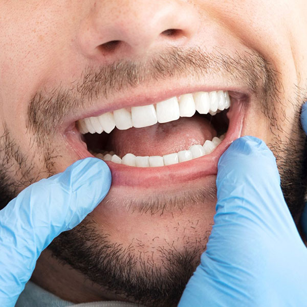 Image of a healthy mouth