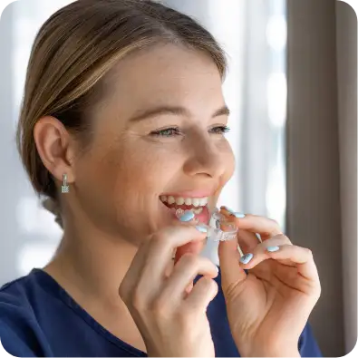 Clear aligners image