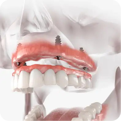 Restorative dentistry graphic